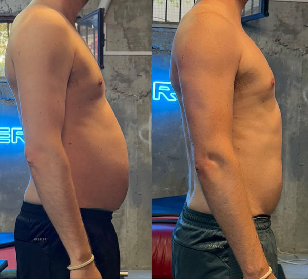 Ignacio M., 45 años